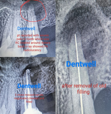 Dentwell treatments